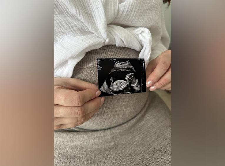Hands holding an ultrasound image of a fetus in front of a stomach.